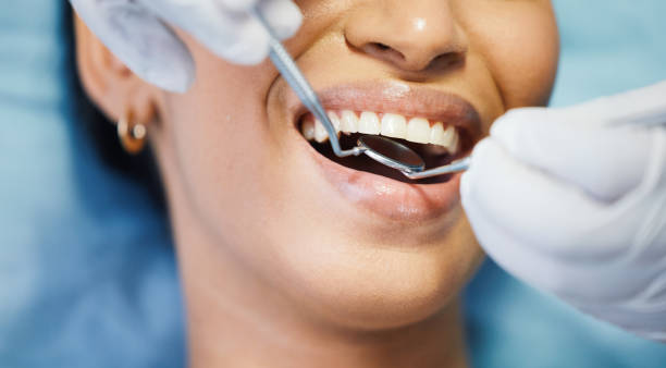 Best Emergency Treatment for Dental Infections or Abscesses in Kendall, FL