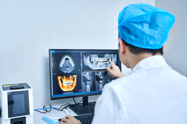 Best Emergency Gum Treatment in Kendall, FL